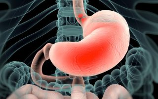 Hogyan ismerjük fel a csecsemőkori reflux tüneteit?