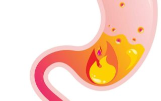 Relaxációs technikák a reflux tüneteinek enyhítésére